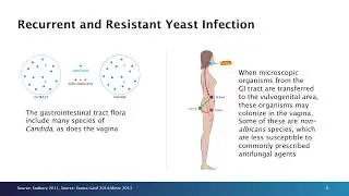 Resistance in Vulvovaginal Candidiasis (VVC)—A Growing Problem