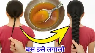 DIY onion Oil for Hairgrowth/बाल झड़ना बंद बाल लम्बे काले घने मजबूत होंगे/bal badhane wala tel #yt💯