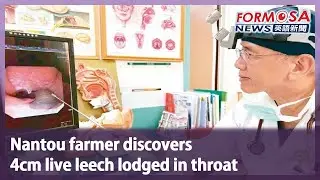 Nantou farmer discovers  4cm live leech lodged in throat｜Taiwan News