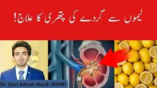 Magic of Lemon juice in Kidney Stones | Lemon Water Benefits