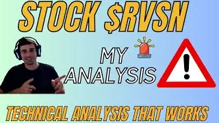 What's Going On With Stock $RVSN (Rail Vision)? My Analysis and Thoughts