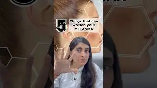 Melasma | What increases pigmentation? | Melasma treatment by Dermatologist | Melasma Skincare