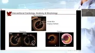 Towards Imaging-Based Patient Stratification for Interventional Cardiology and Nephrology