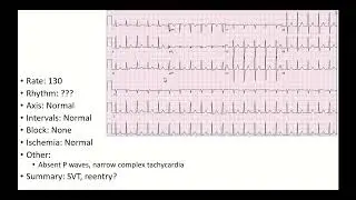Practice ECG - Basics (2-10)