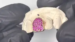 Single Tooth Grillz Iced Out w Hot Pink Sapphires (14K, Yellow Gold) | Luxe Grillz