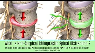 What Is Chiropractic Spinal Decompression Meridian Idaho |  Gonstead Spine & Wellness Meridian Idaho
