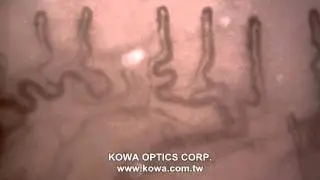 MC-380 Microcirculation Inspection Scope - KOWA OPTICS CORP.
