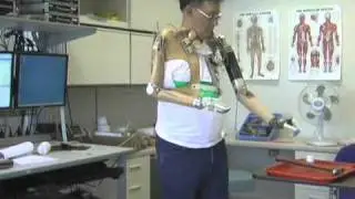 Bionic arm