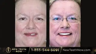 DENTAL IMPLANTS Help Rita Smile Again  - New Teeth Now