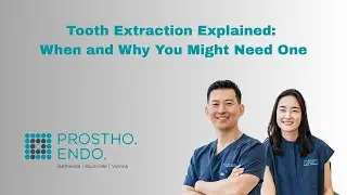 Tooth Extraction Explained: When and Why You Might Need One | Prostho Dental Maryland & Virginia