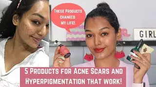 5 Products for Acne Scars and Hyperpigmentation THAT ACTUALLY WORK! #SkinTalkWSarah EP 10
