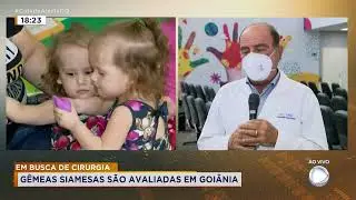 EM BUSCA DE CIRURGIA: GÊMEAS SIAMESAS SÃO AVALIADAS EM GOIÂNIA