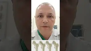 ПРОФИЛАКТИКА И ПРАВИЛЬНАЯ ДИАГНОСТИКА ОСТЕОПОРОЗА