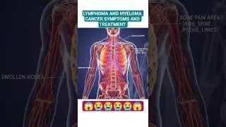 LYMPHOMA AND MYELOMA CANCER SYMPTOMS AND TREATMENT #shorts #viral #trending #chronicmyeloidleukemia