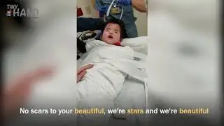 A girl born without eyes SINGING to keep calm during a brain scan