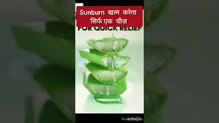 sunburn  dur  karane ke  upay#surburn treatment #aloevira  gel#beauty tips#lady topic