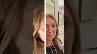 Ringraziamo Cecilia che ci mette la faccia e offre la sua testimonianza dopo intervento di Blefaro.