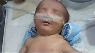 Fazl Neonatologist | Neonatal Care & NICU Education