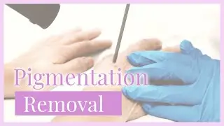 CMC Pigmentation Removal
