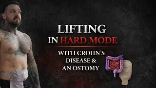 Training with Crohn&rsquo;s Disease & an Ostomy