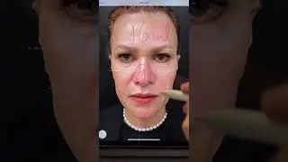 😱 “3 Harmonizações de Alto Nível! Dr Renato Maggio — Veja os Resultados e Inscreva-Se!”