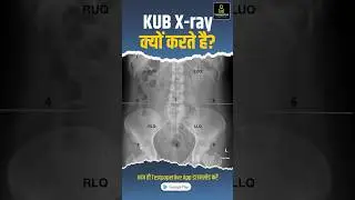 KUB X-ray Test Purpose, Preparation & Procedure | radiographer #xraytechnician #peramedical