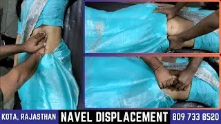 Navel displacement, Constipation, Gas and acidity, Abdominal pain and swelling - Get Fastest relief!