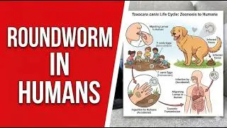 Would You Imagine Your Dog Giving You Parasites? Dangerous Toxocara Look Like an Alien!