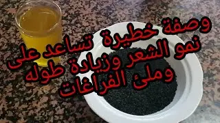 وصفة خطيرة للشعر المتساقط أو من يعاني من الصلع👨‍🦲 جربيها وردي عليا لخبار 🤔