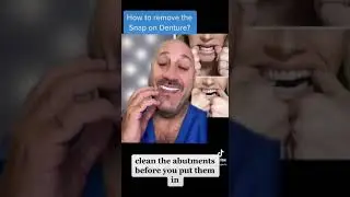 How to remove Snap in Dentures? Unveiling 𝐒𝐧𝐚𝐩-𝐈𝐧 𝐃𝐞𝐧𝐭𝐮𝐫𝐞 𝐑𝐞𝐦𝐨𝐯𝐚𝐥 𝐇𝐚𝐜𝐤𝐬: Expert Advice Cleaning