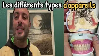 Les différents types d'appareils dentaire  أنواع طقم الأسنان الإقتصادية والجيدة في الاستعمال