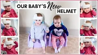 GUESS WHO GOT A HELMET! OUR BABY DOC BAND HELMET JOURNEY | BABY&rsquo;S HEAD SHAPE | TWIN MOM