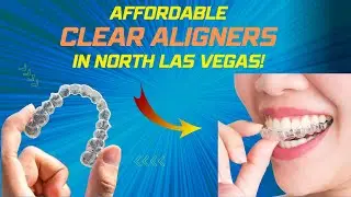 Affordable clear aligners in North Las Vegas (702) 329-3230 NLV Invisalign alternative special offer