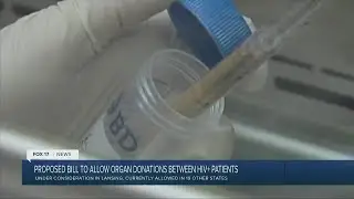 Proposed bill would allow organ donations between HIV-positive patients