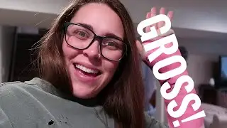 Getting my Cast off during Quarantine 2020 | I let my kids decorate my cast!