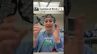 What are the risks associated with epidurals?