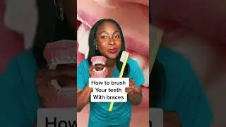 How to brush Your teeth with braces #braces #howto #teeth #dentalhygienist