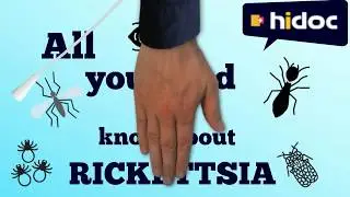 Rickettsia