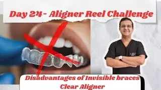 Invisalign and Clear Aligners Problems | Honest dentist opinion . # aligner #invisalign 
