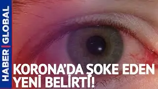 Koronada Şoke Eden Yeni Belirti!