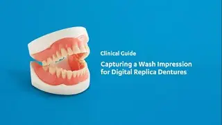 How to Capture a Wash Impression for Digital Replica Dentures | Southern Cross Dental ANZ
