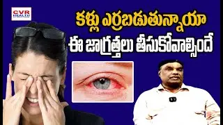 కళ్లు ఎర్రబడుతున్నాయా | Eye infections Treatment | CVR HEALTH