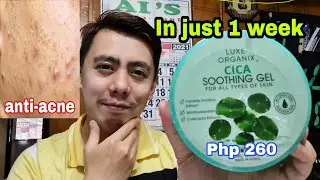 5 TIPS HOW TO REMOVE ACNE IN 1 WEEK | LUXE ORGANIX CICA SOOTHING GEL WHITENING MOISTURIZER REVIEW