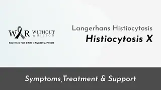 Langerhans Histiocytosis (Histiocytosis X) - Without a Ribbon