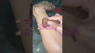 ขัดผิว ไม่ใช่เรื่องยากอีกต่อไป