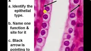 Epithelium Data Show Revision