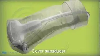 eTRAX&trade; Needle Guidance System: Revolutionizing Real-Time Ultrasound Navigation