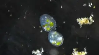 Swimming Ciliates - Behaviors in Pond Water