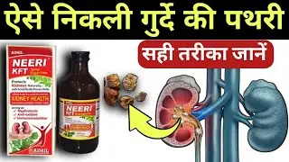 Neeri KFT Syrup ke Fayde in Hindi | Neeri Syrup | Kidney stone Treatment 