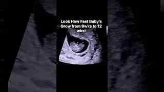 Baby&rsquo;s Grow and Change so Fast! #jerbearimaging #athomesonogram #foryoupage #growingbaby #sono